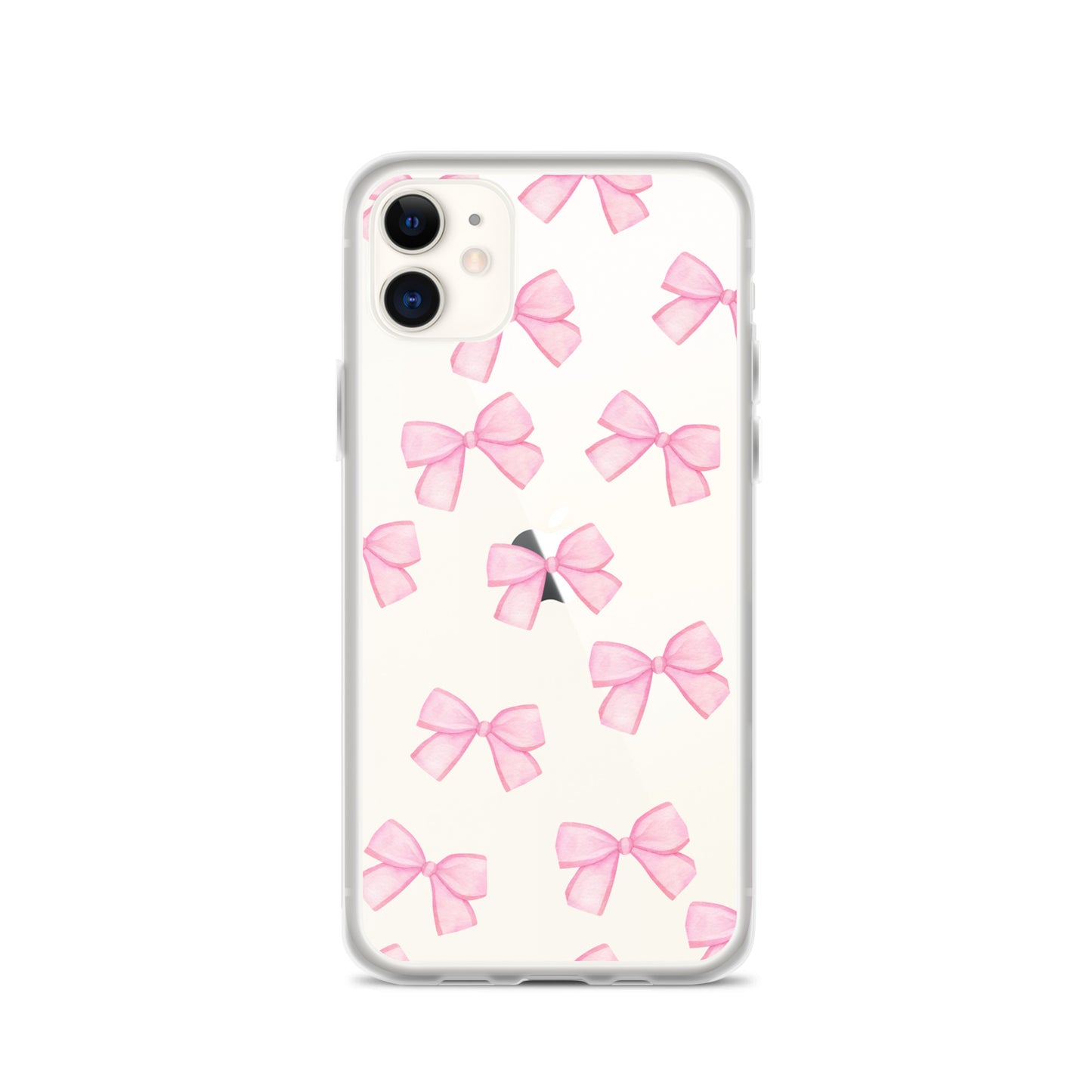 Pink Bows Clear iPhone Case