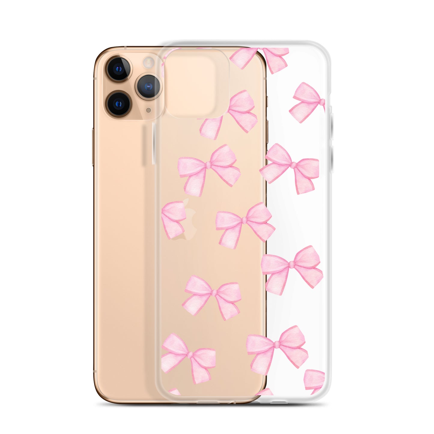 Pink Bows Clear iPhone Case