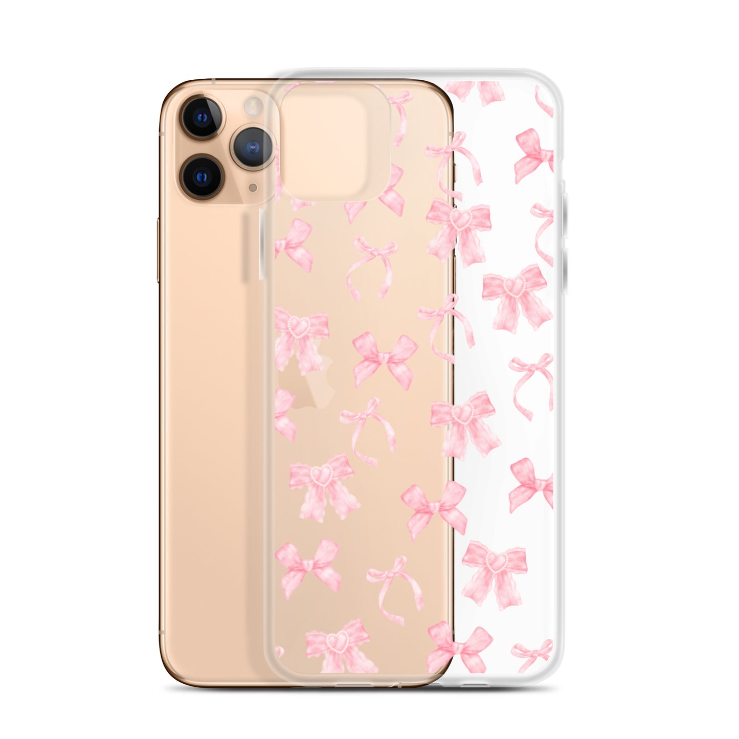 Coquette Bows Clear iPhone Case