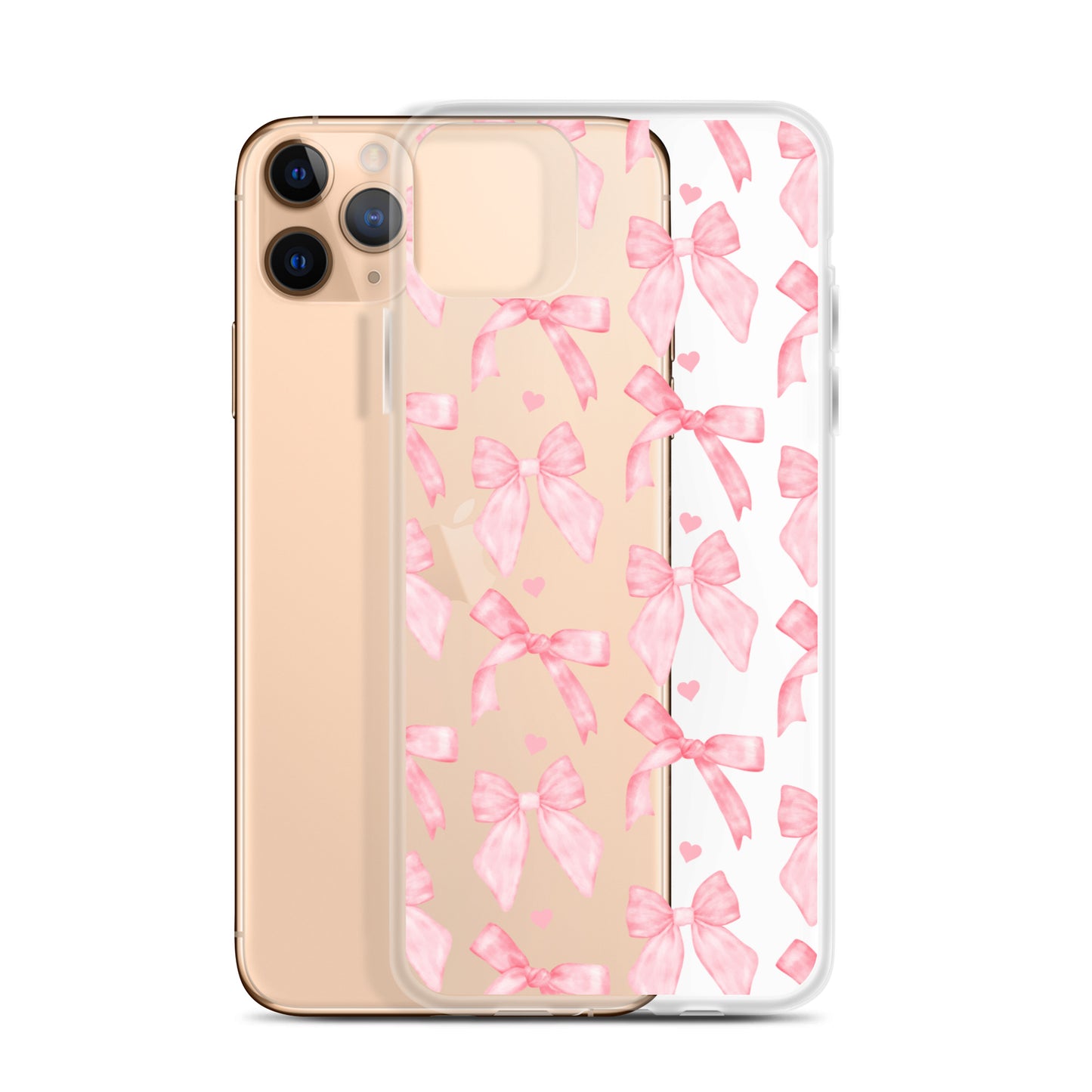 Flirty Bows Clear iPhone Case