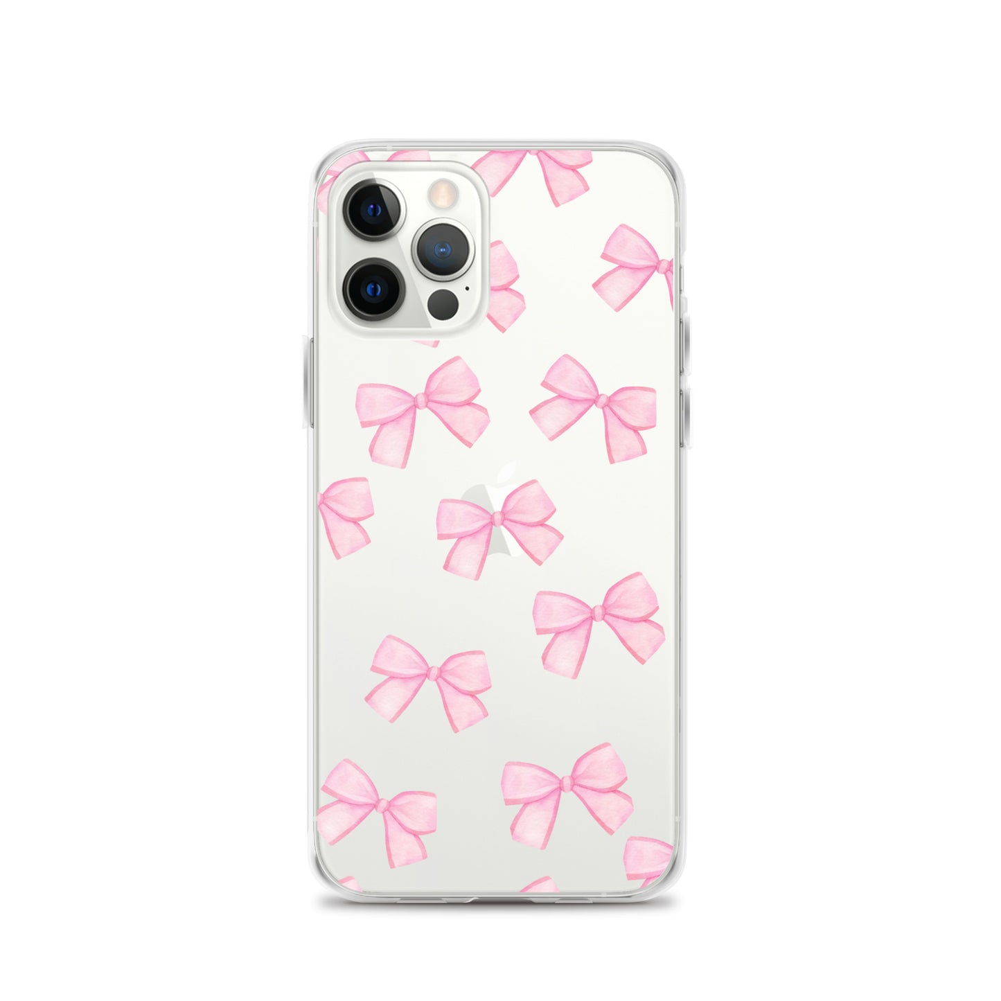 Pink Bows Clear iPhone Case