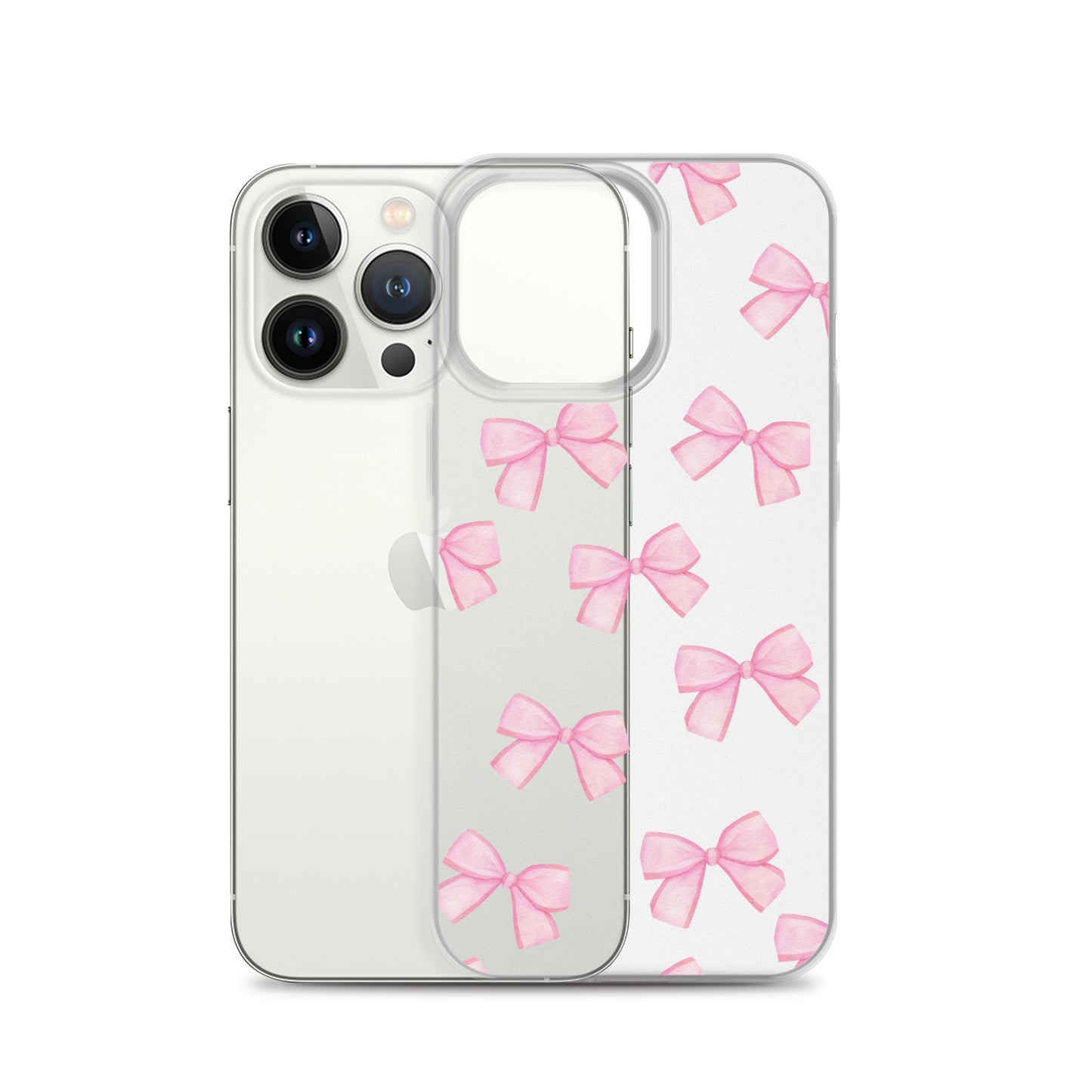 Pink Bows Clear iPhone Case