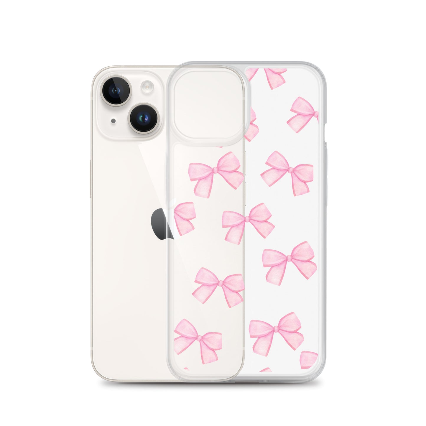 Pink Bows Clear iPhone Case