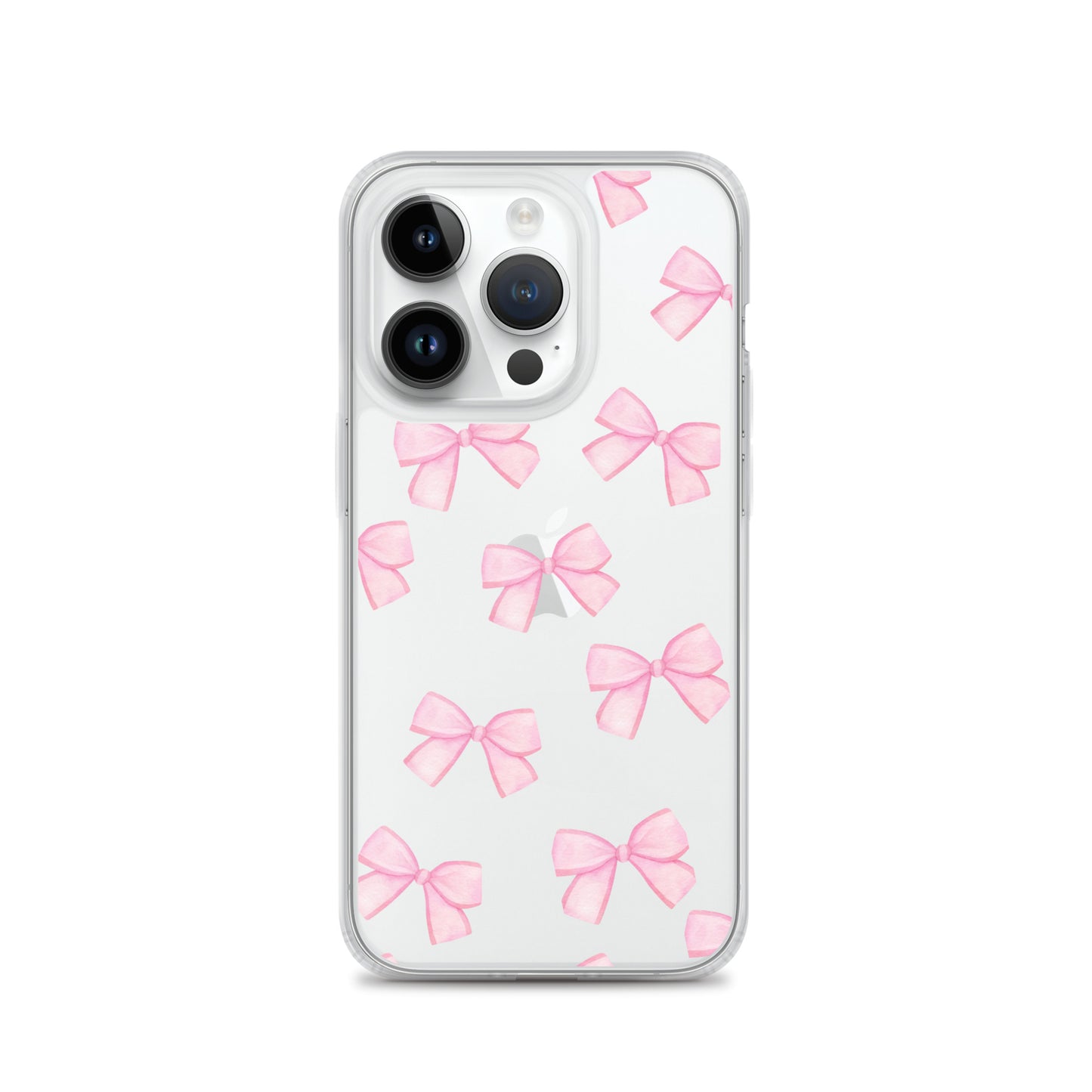 Pink Bows Clear iPhone Case